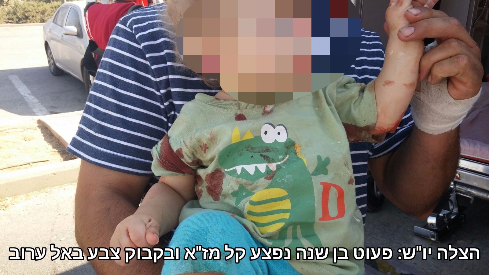 פעוט כבן שנתיים נפגע מאופנוע באורח קשה סמוך ליער בית קשת