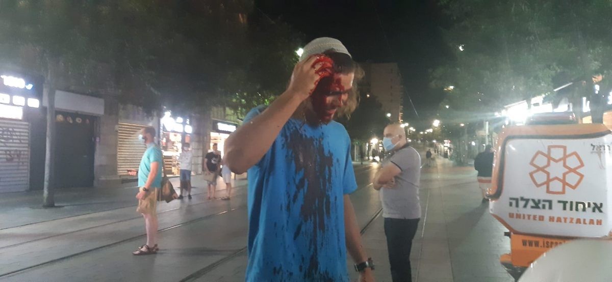 אלימות להט"בית: צעיר הובהל לבית חולים