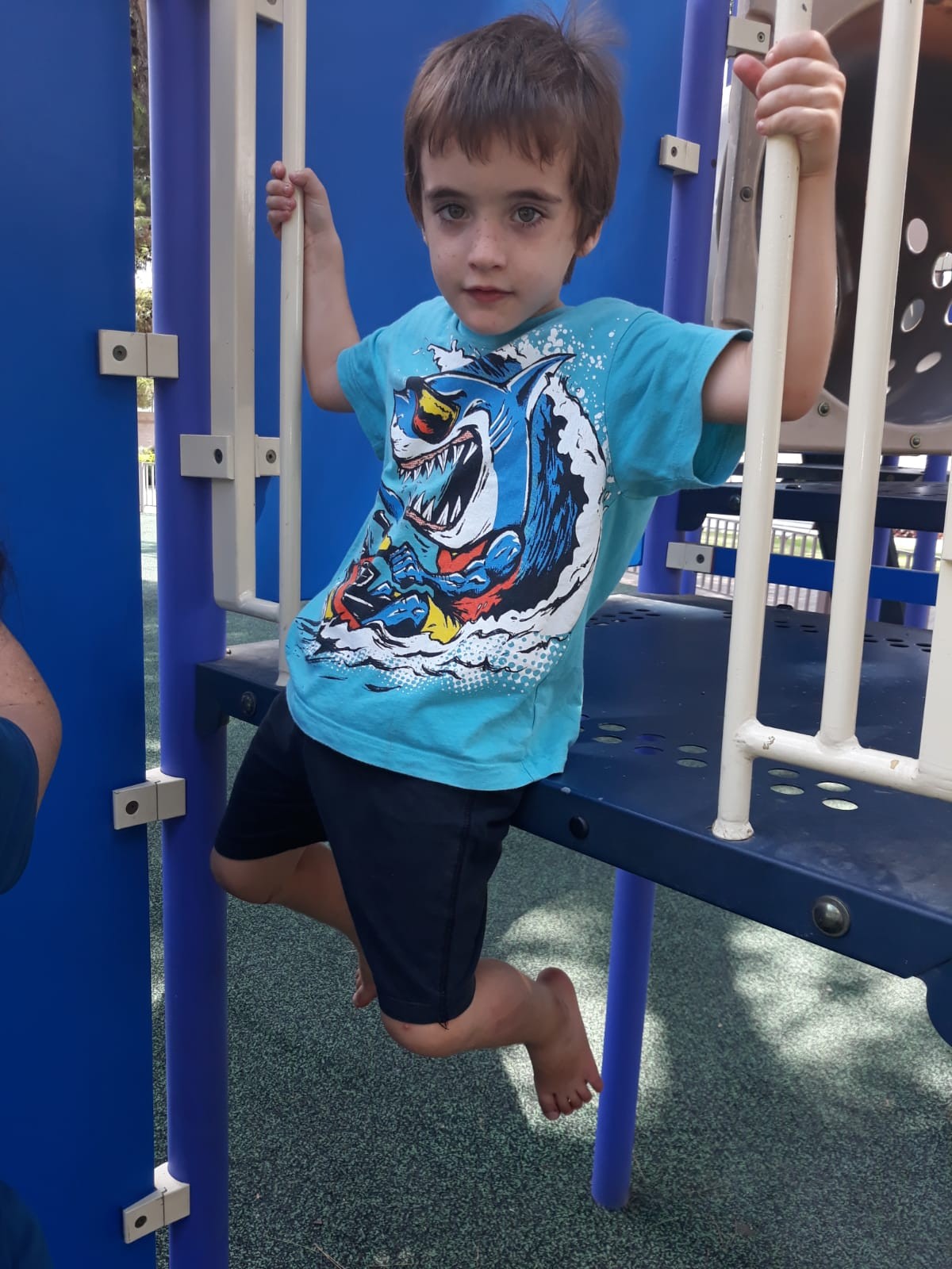 ליעד בן ה-6 טבע למוות - רקמותיו וקרניותיו ייתרמו