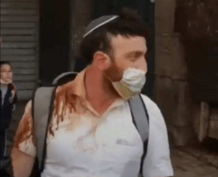 מעצרם של הערבים שתיעדו עצמם שופכים קפה על יהודי הוארך