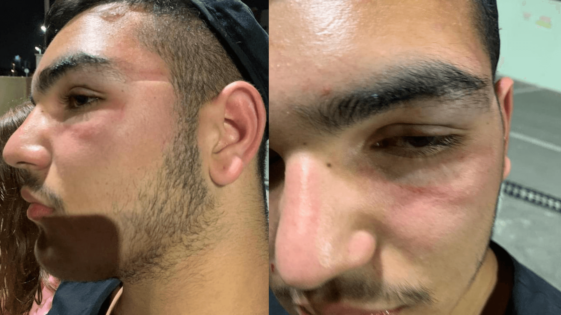 ערבים תקפו באלימות קשה יהודי בבאר שבע