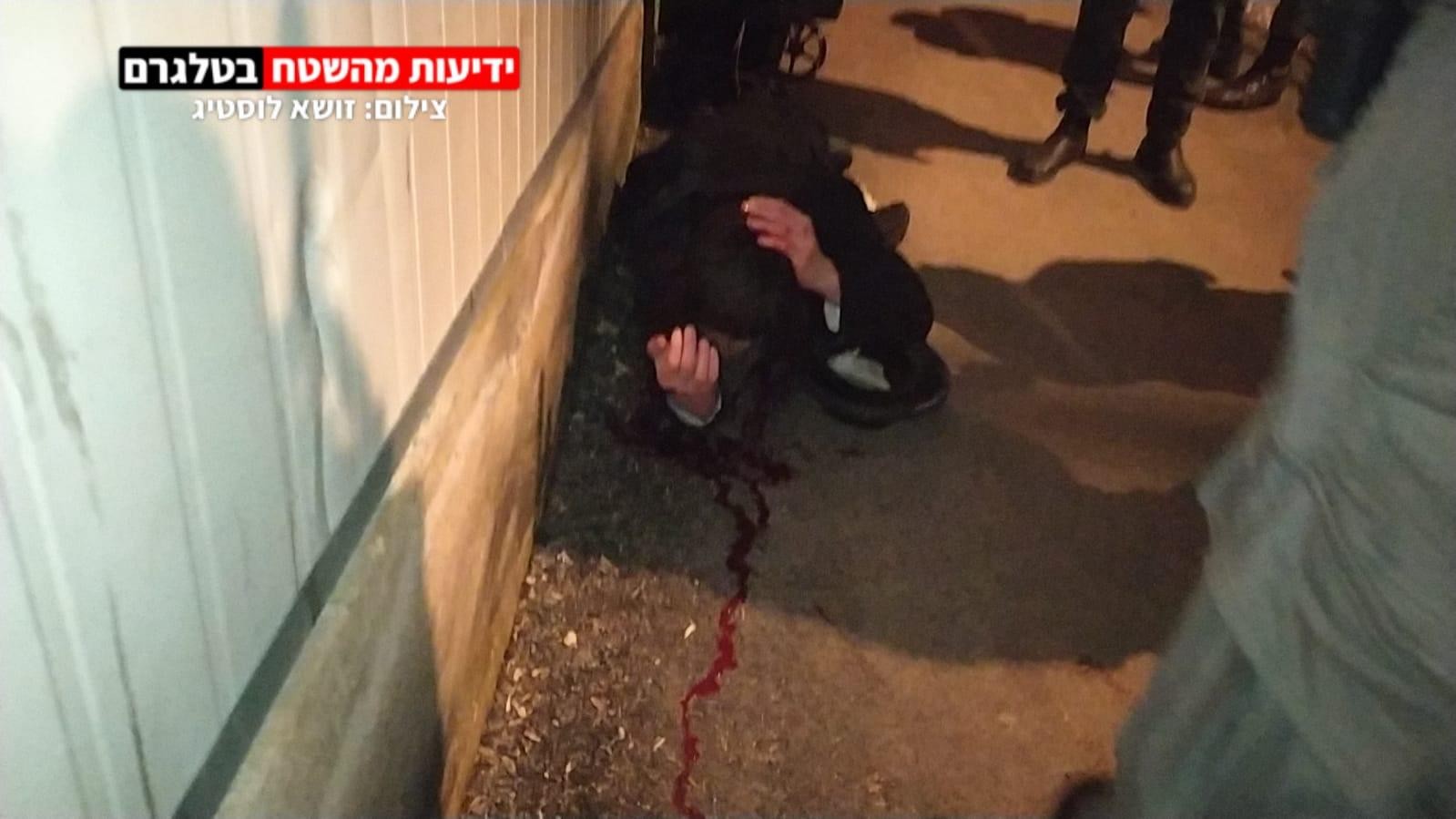 ראשוני: מאבטח ערבי תקף מפגין חרדי בראשו - מצבו בינוני