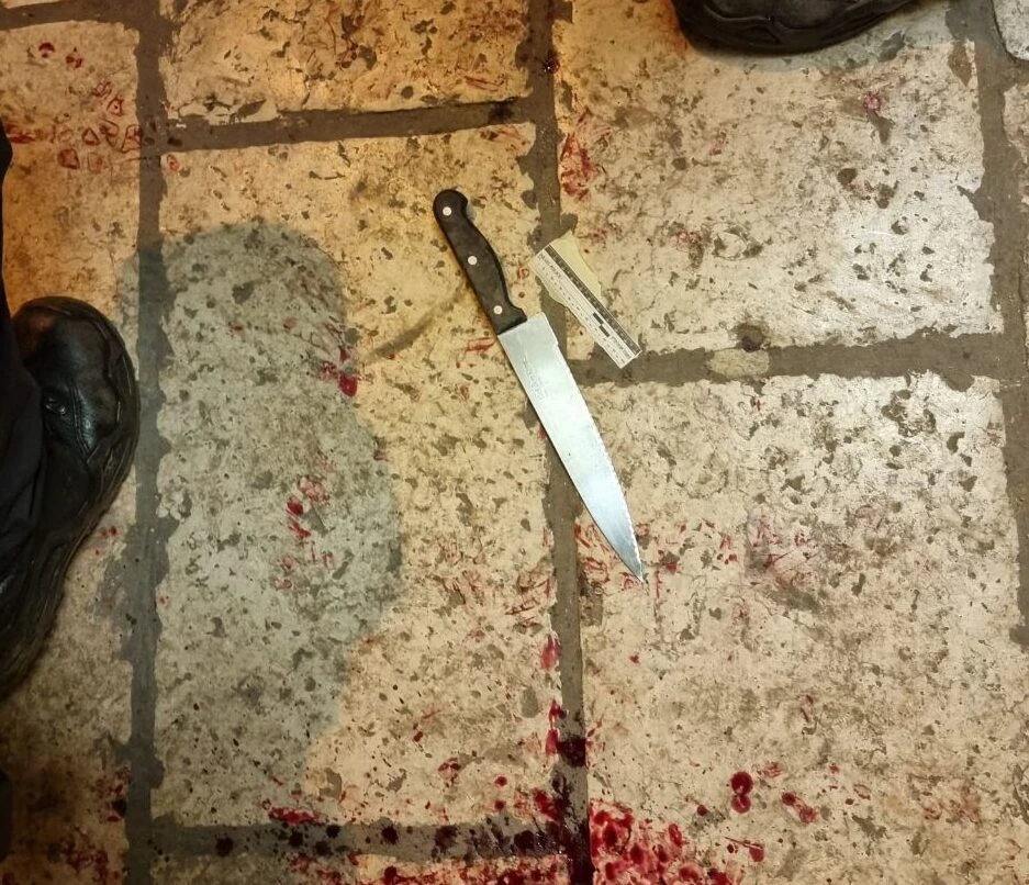 פיגוע דקירה בירושלים. צילום: דוברות המשטרה