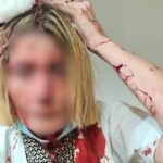 שוב: אלימות קשה כלפי רופאת כללית בבאר יעקב