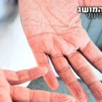 תמיד תהיתם? זו הסיבה האמיתית להתקמטות העור במים