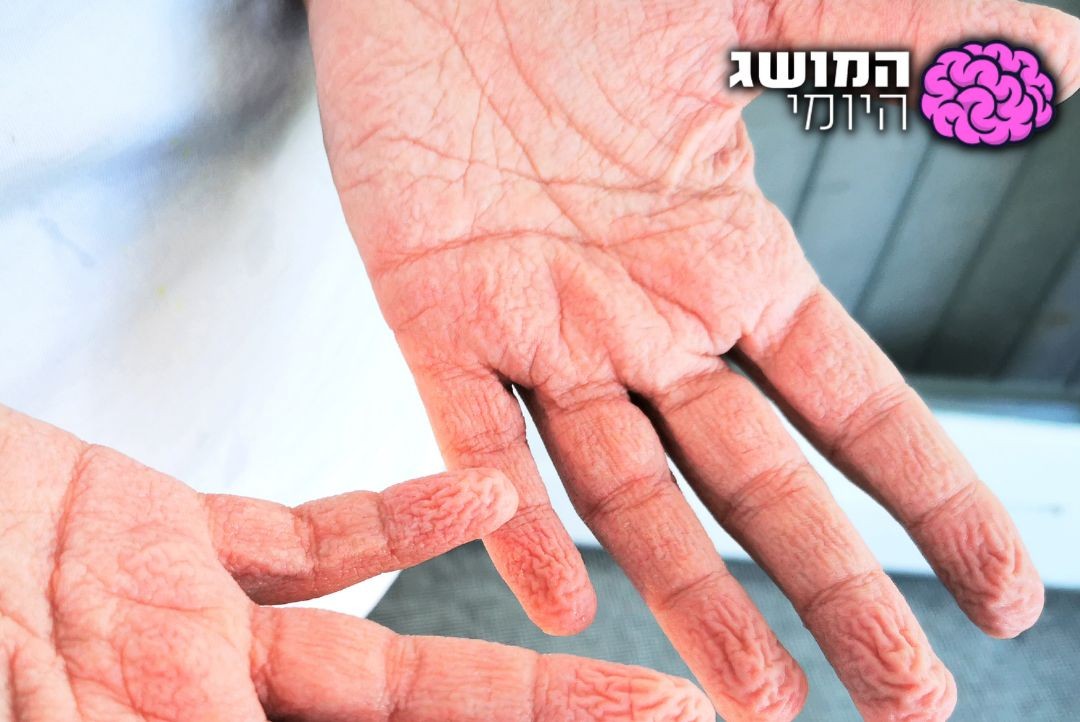 תמיד תהיתם? זו הסיבה האמיתית להתקמטות העור במים