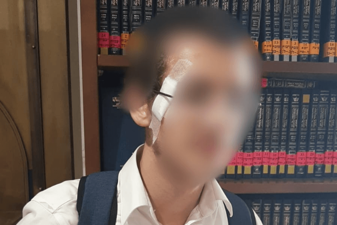 מכעיס: צעיר חרדי הותקף באלימות ע"י צעיר ערבי ברכבת הקלה בי-ם