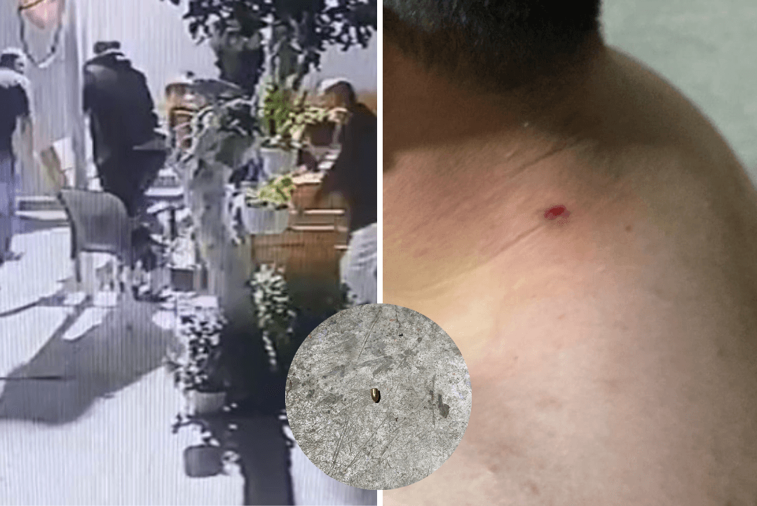 מציאות בלתי נתפסת בדרום: ישב עם חבריו בחצר וכמעט נורה למוות | תיעוד