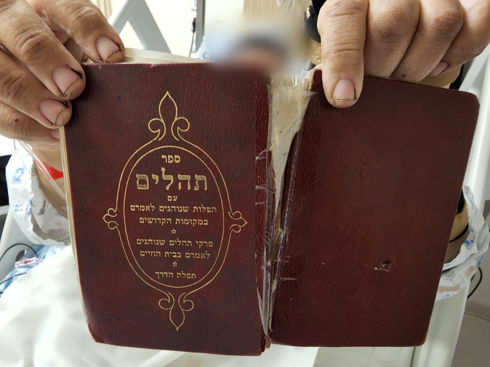 ספר תהילים הציל את חייו של הפצוע קשה בפיגוע בירושלים