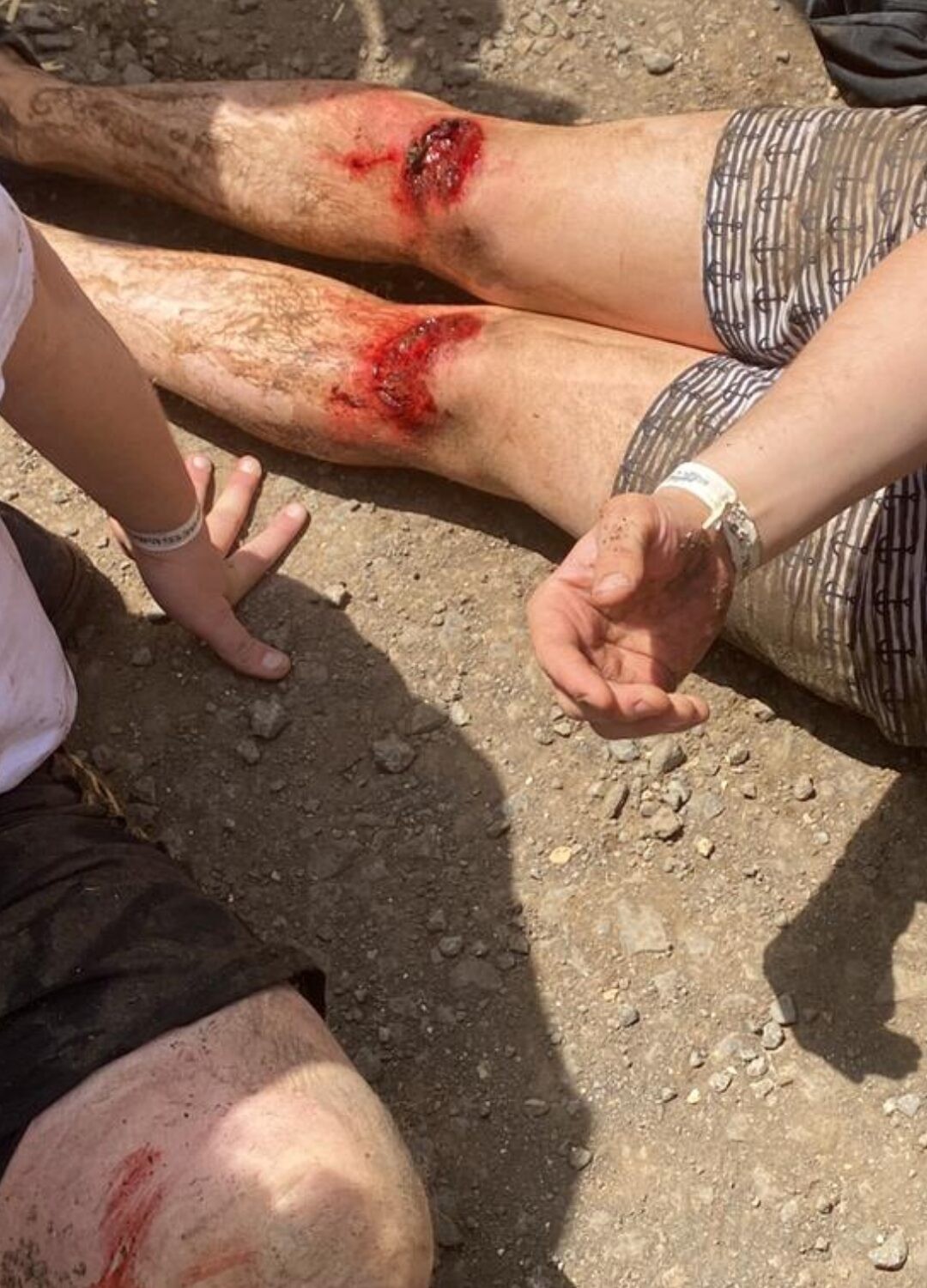 הדריסה באתר הרפטינג בצפון: תאונה או אירוע לאומני?