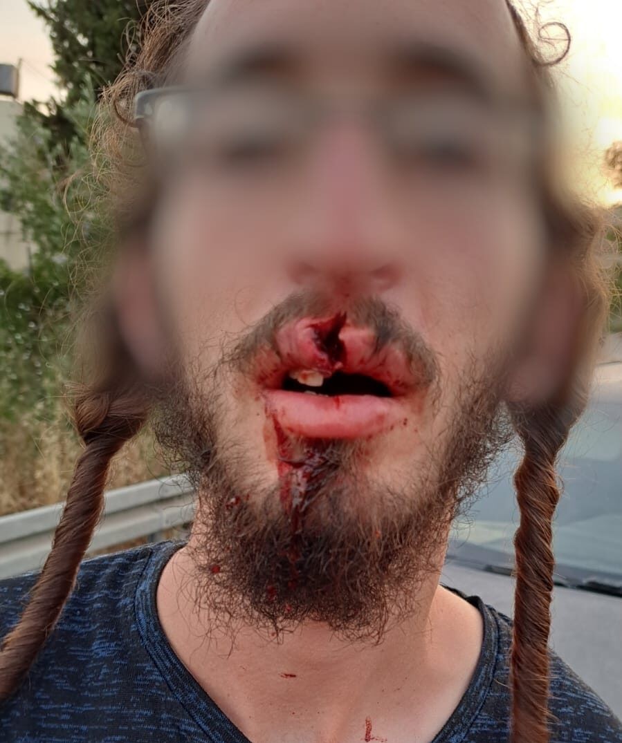 הטרור בשומרון נמשך: שני יהודים נפצעו מזריקת אבנים