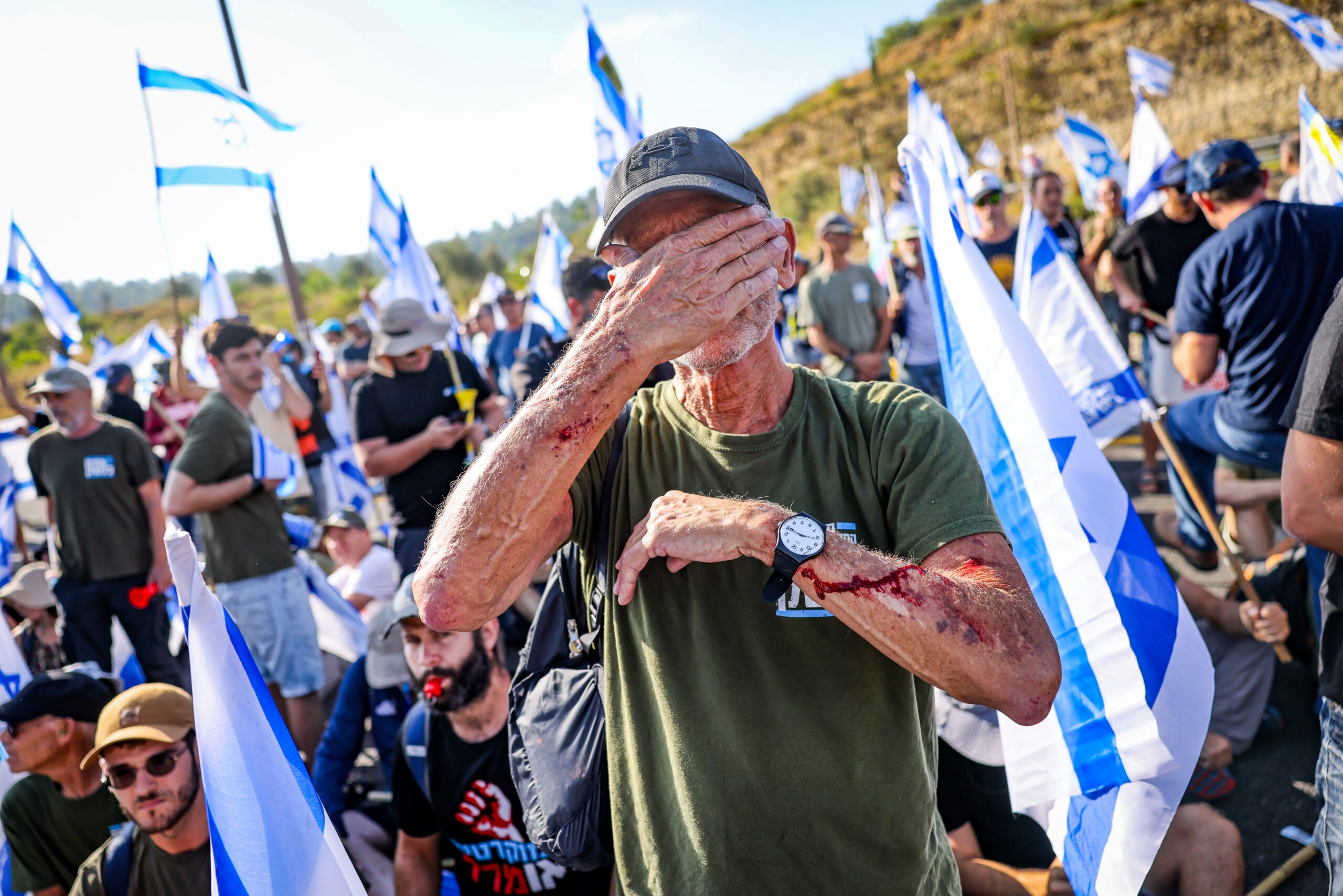 "בושה בשם הדמוקרטיה" | אל"מ (במיל') טל בראון