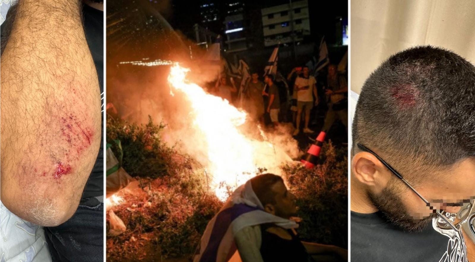 מחאה אלימה: שוטר נפצע בגופו ובראשו במהלך הפרות הסדר באיילון