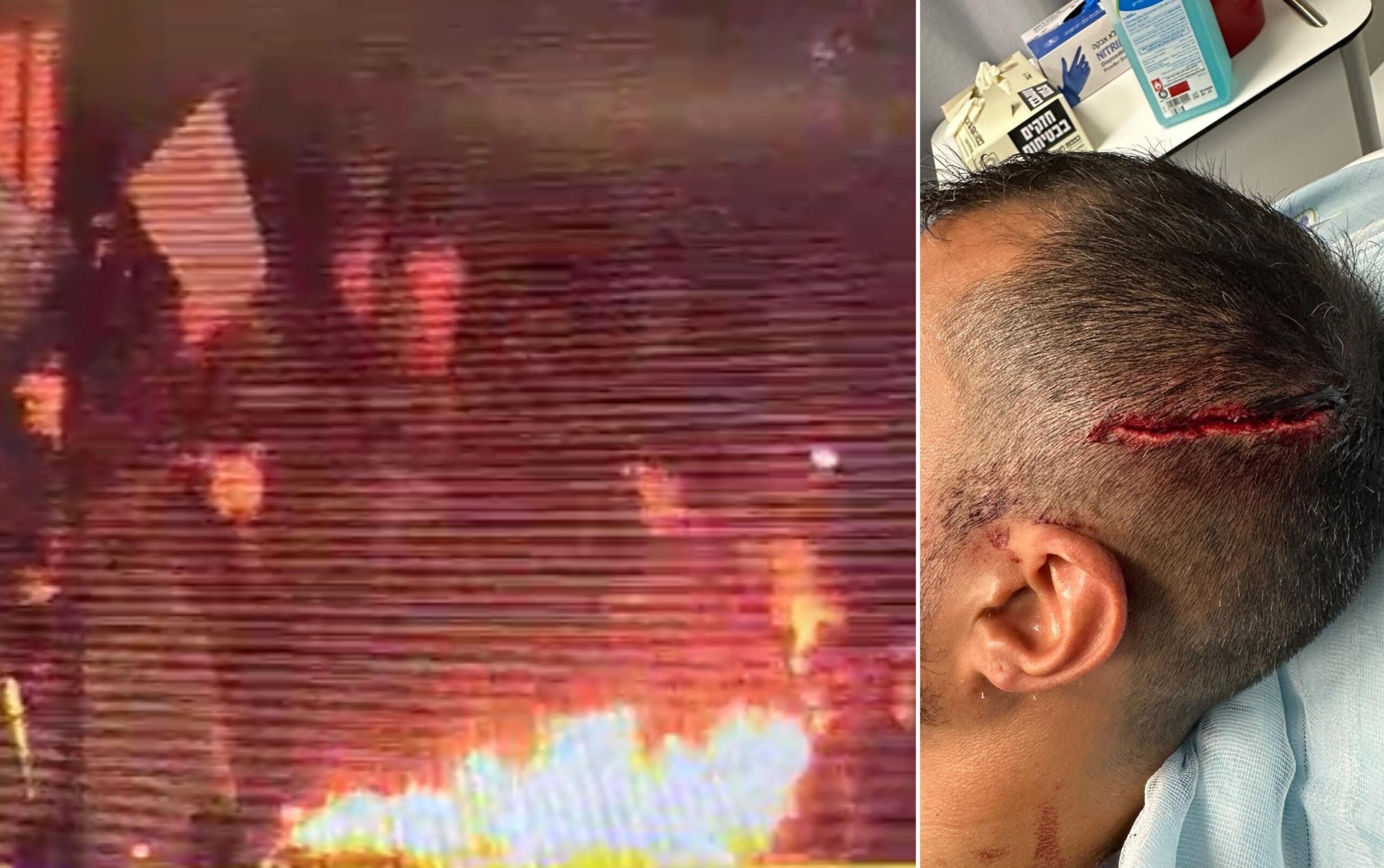 שוטר שנפצע מאבנים, השלכת הבקת"ב במחאת צדק לרפאל | צילום: דוברות המשטרה