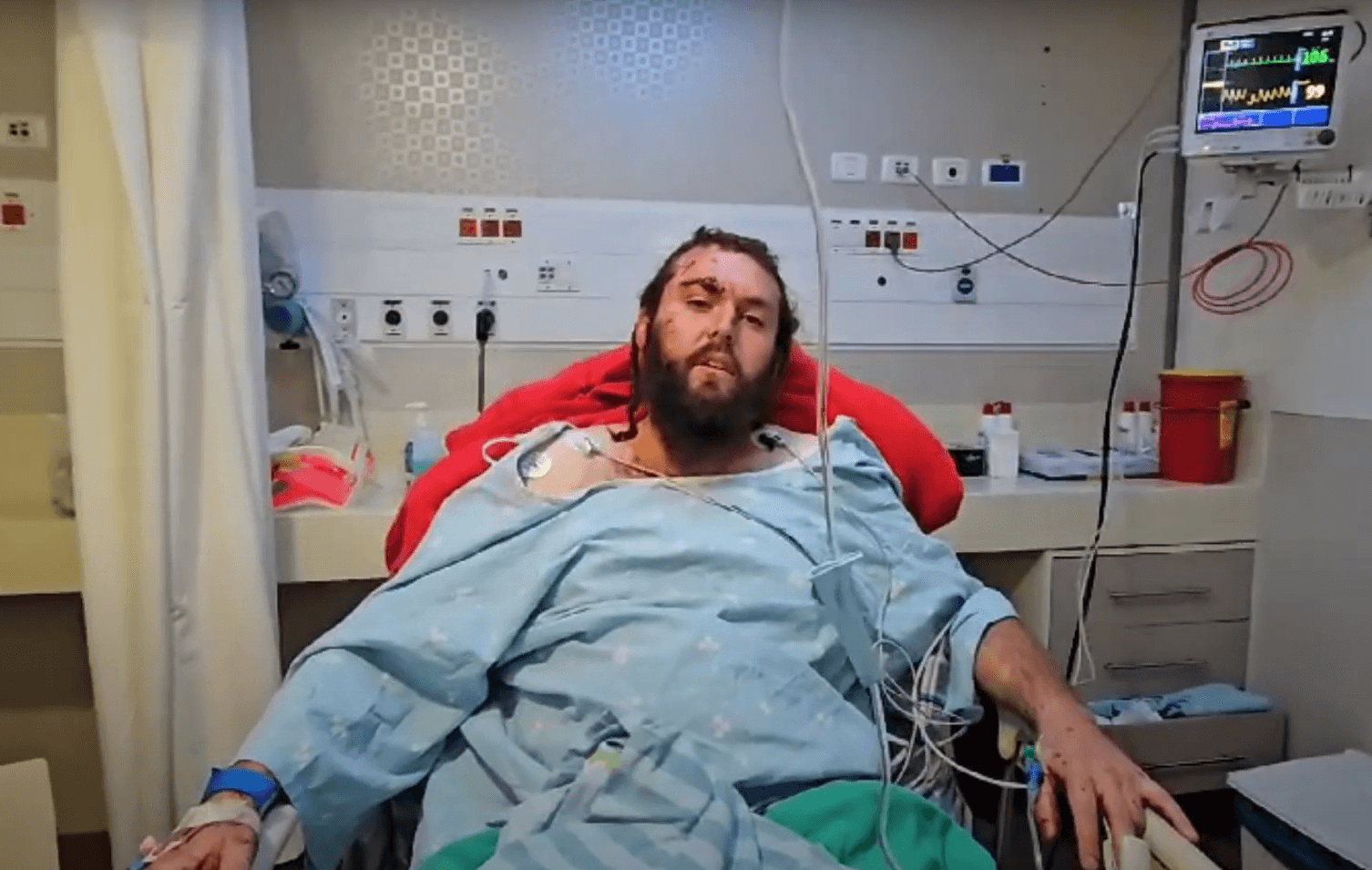 הפצוע בפיגוע בחווארה, אחיעד ליבמן משחזר | צילום: מועצה אזורית שומרון