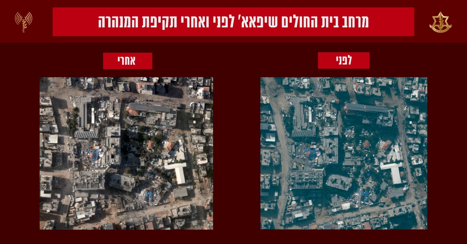 כך צה"ל השמיד את תוואי המנהרות מתחת ומסביב לביה"ח 'שיפאא'