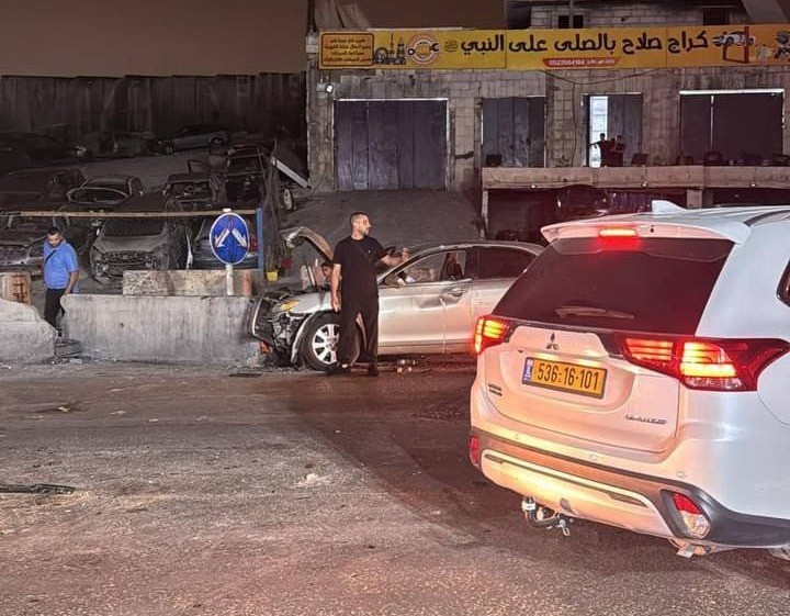 ערבים ניסו לבצע לינץ׳ ביהודי שנכנס לקלנדיה במזרח ירושלים.
בכוחות עצמו הגיע עצמאית למחסום הסמוך כשהוא פצוע | צילום: שימוש לפי 27 א