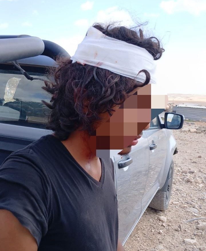 ערבים ביצעו לינץ' ברועה צאן: "היינו כפסע מבנימין אחימאיר 2"