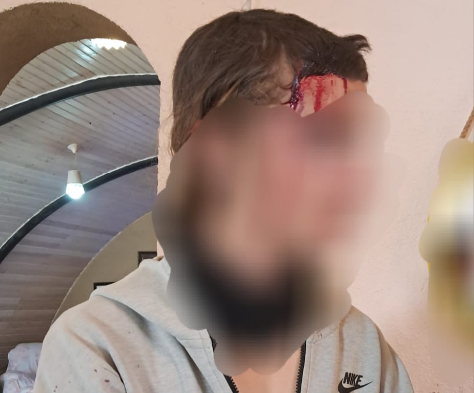 בחסות פעילי שמאל קיצוני: ערבים פצעו רועי צאן בהר חברון