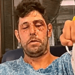 עידן עמדי חשף תיעוד מצמרר מהשיקום: "יש עוד מה לתקן" | צפו