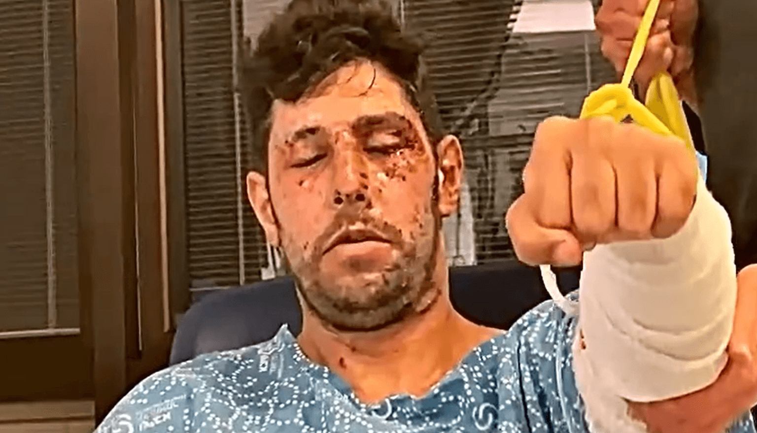 עידן עמדי חשף תיעוד מצמרר מהשיקום: "יש עוד מה לתקן" | צפו