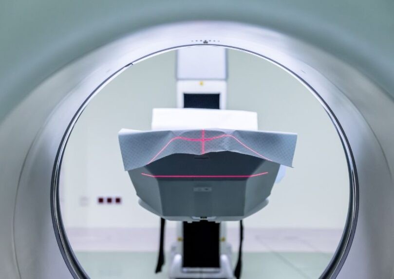 אסון בניו יורק: גבר מת לאחר שנכנס לחדר MRI עם שרשרת מתכת