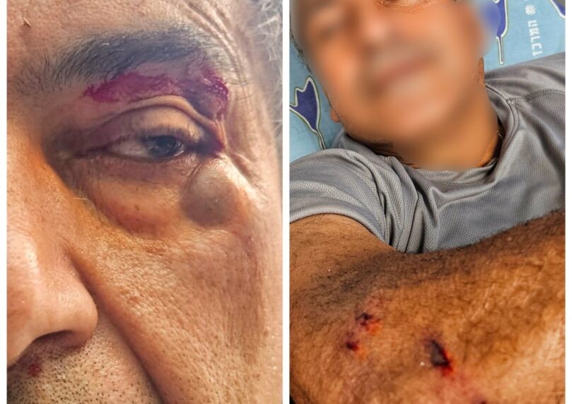 בתוך ביתם: הוריו של "הצל" הותקפו באלימות קשה על ידי פורץ