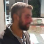 רב בישיבת ההסדר ביפו הותקף באלימות על ידי ערבים