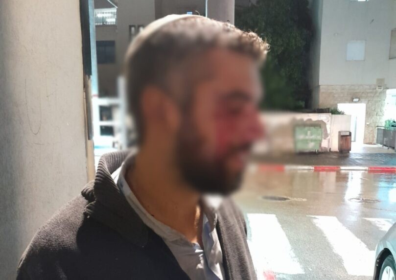 פרסום ראשון: נעצר חשוד בתקיפת הרב בישיבת ההסדר ביפו