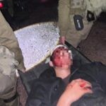 פיגוע בבקעת הירדן: נער יהודי נפצע קשה בראשו – המחבל חוסל