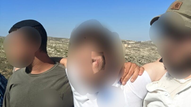"עברתי לינץ', איבדתי הכרה": פצוע הלינץ' מעופרה משחזר | צפו