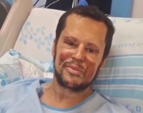 "זכיתי לתת רגל": סיפורו המצמרר של בועז תמם שנפצע בלבנון