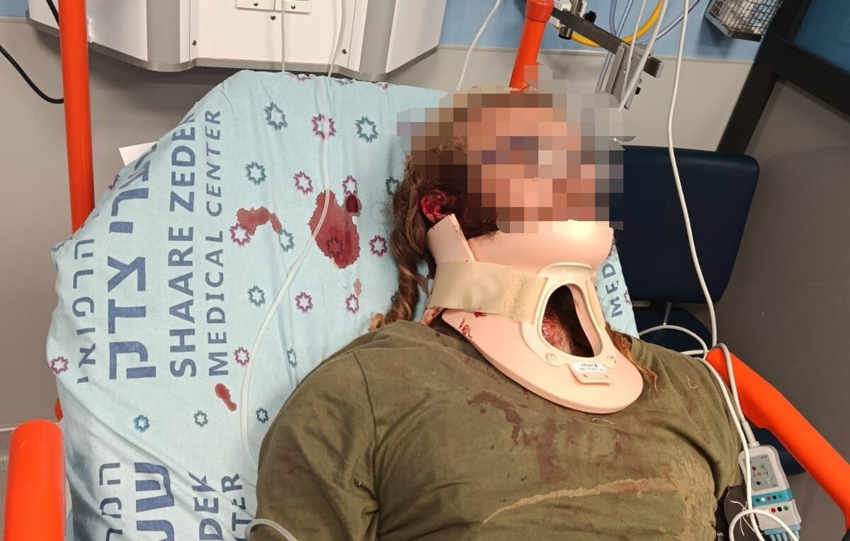Israel Arrests Four Arab Terror Suspects in Attack on Jews