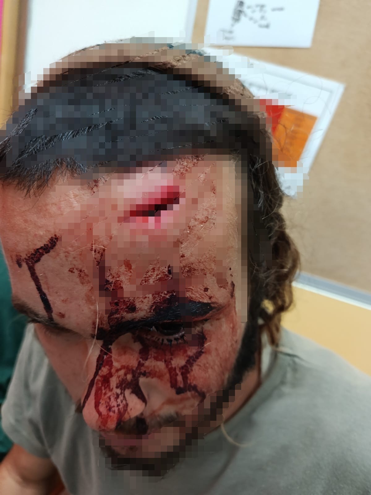 Israel Arrests Four Arab Terror Suspects in Attack on Jews