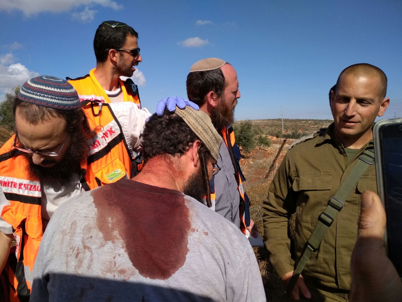 אחד הנפגעים הישראלים בתקרית. צילום: TPS
