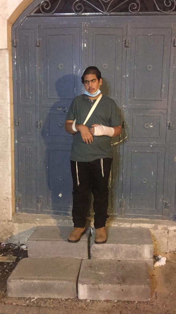 פיד, אלימות, שוטרים, שימי, שמעון מרציאנו, נצ''מ, מפגים, חרדי