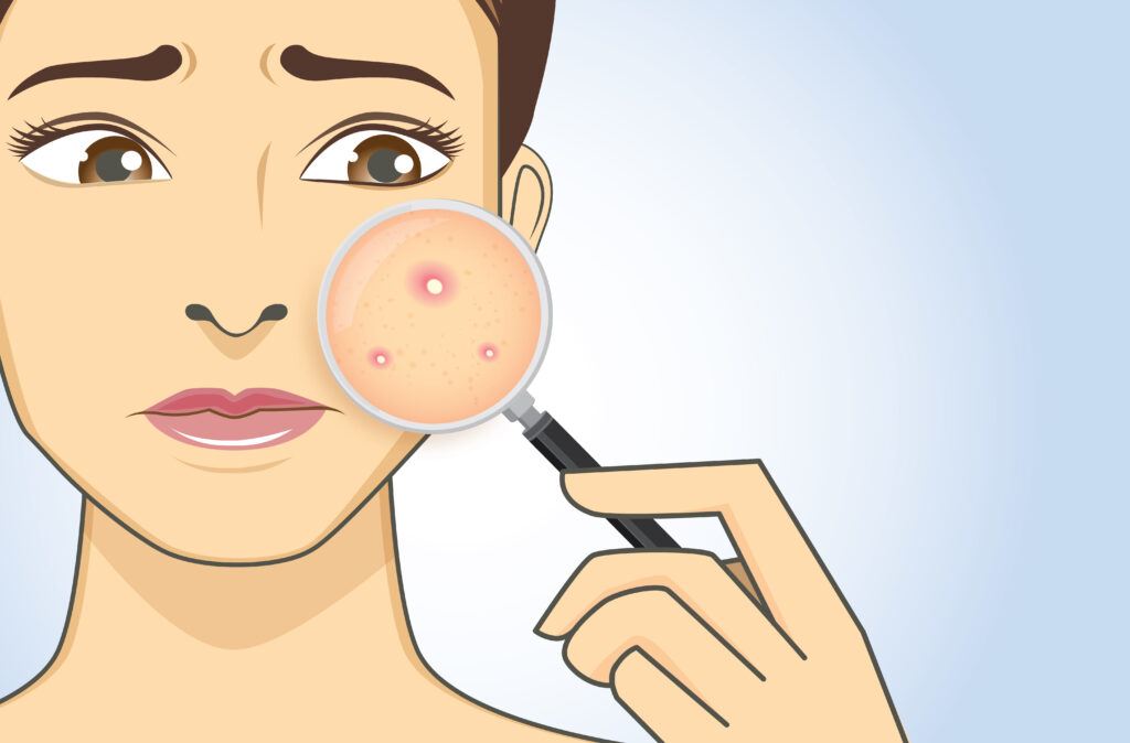 skin problem